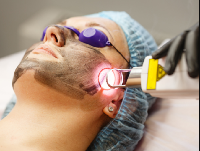 The Right Large Pores Treatment: How to Choose the Right One?