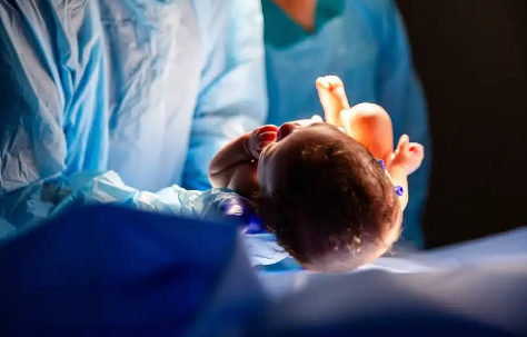 San Francisco Birth Injury Guide: Was It Medical Malpractice?