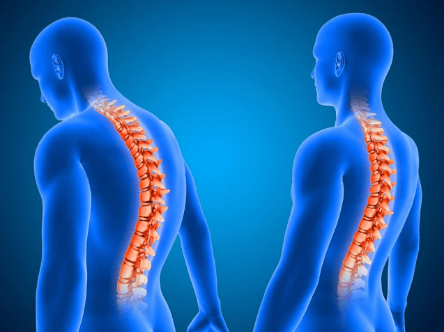 Essential Daily Habits for Maintaining a Healthy Spine